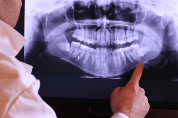Best Emergency Gum Treatment in Royal City, WA