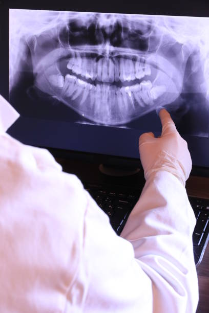 Best Emergency Treatment for Dental Infections or Abscesses in Royal City, WA