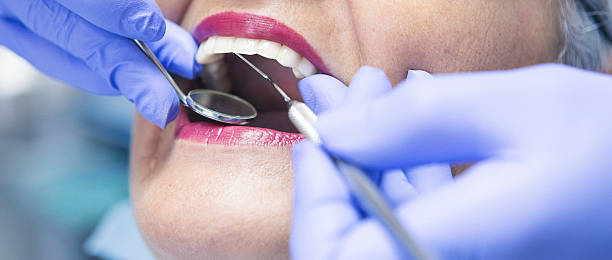 Best Emergency Treatment for Dental Infections or Abscesses in Royal City, WA